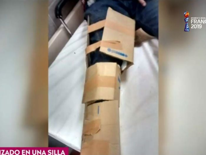 Hospital le dejó la pierna como caja de vino