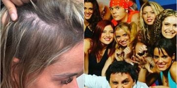 Ex chica Mekano reveló vía redes sociales su lucha contra la alopecia: “Mi intención es ayudar”