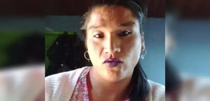 Mujer trans quemada en Valparaíso