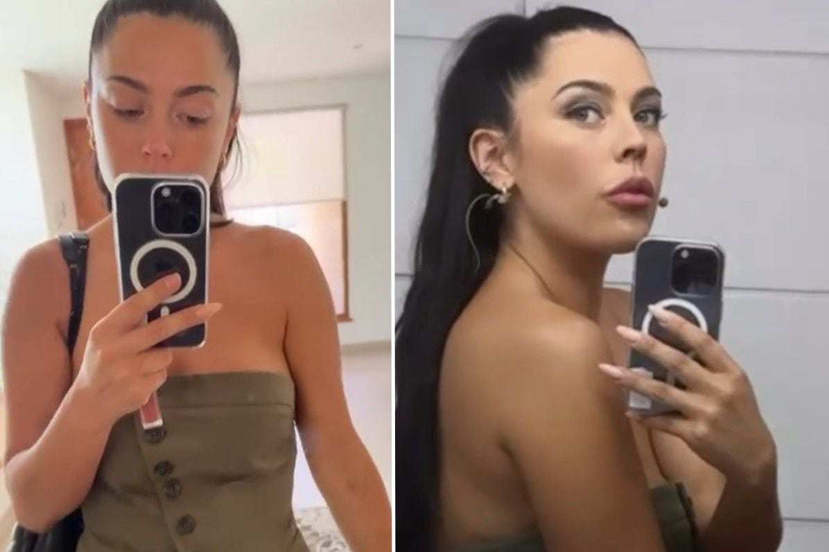 Daniela Aránguiz muestra moretón en un video