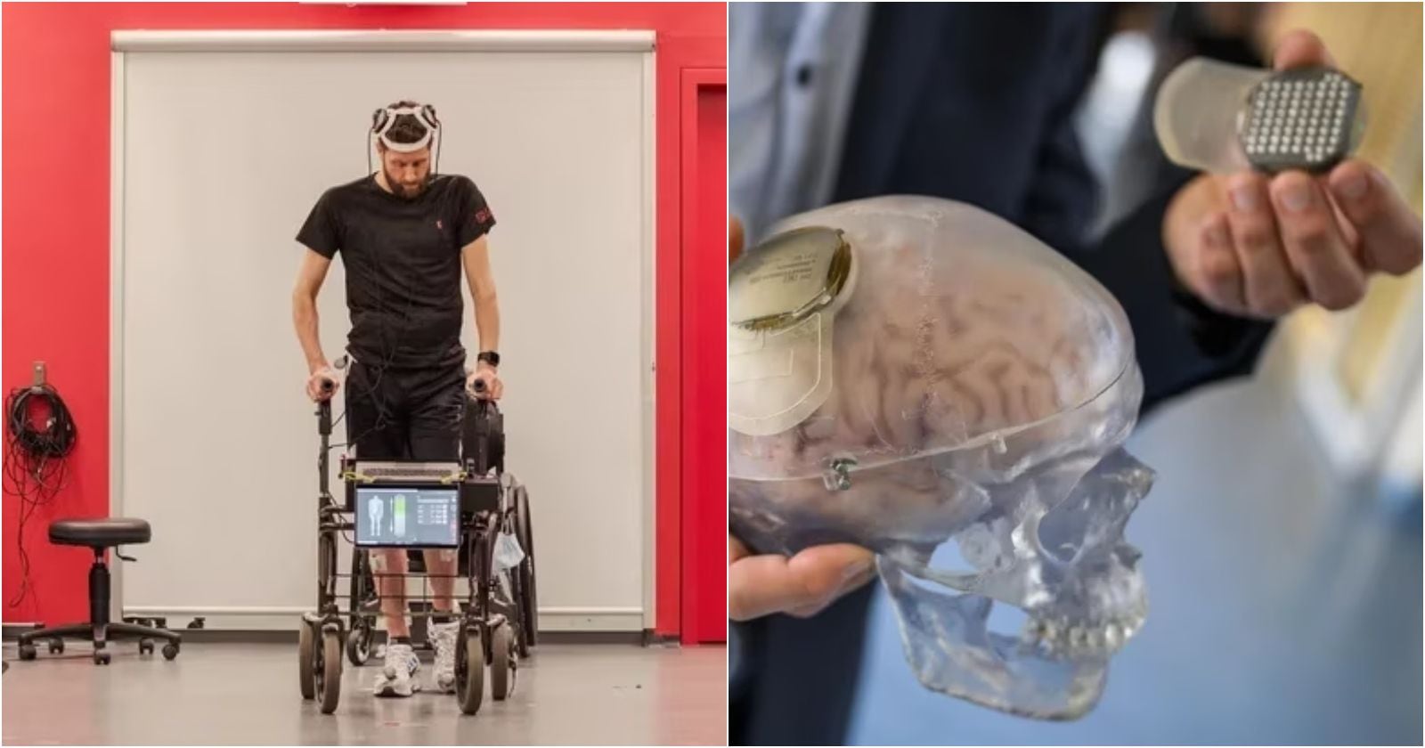 Crean dispositivo cerebral entrenado con inteligencia artificial que permitió a hombre tetrapléjico volver a caminar