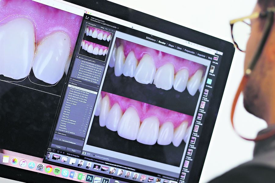 Tecnología le arregla la dentadura "a distancia"