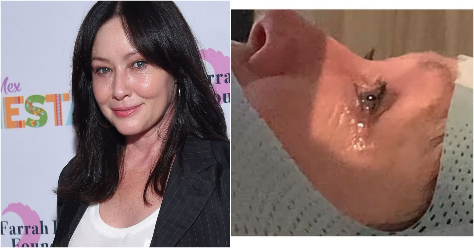 Shannen Doherty contó que tiene metástasis en el cerebro