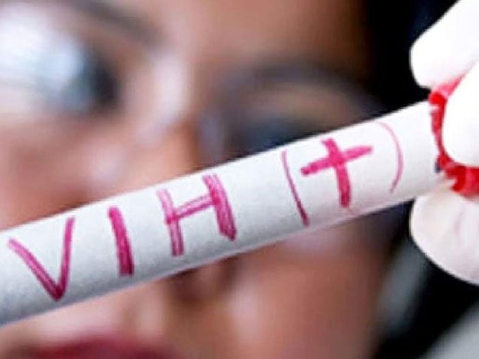 El VIH no discrimina: Universidad de Chile lanza campaña por un "sexo seguro"