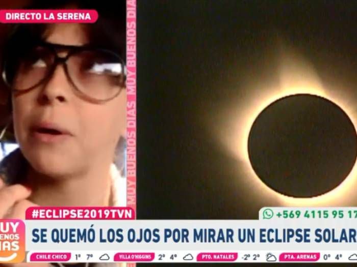 Habla joven que sufrió daños irreversibles en sus ojos por ver eclipse en Quilpué