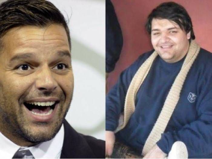 Se operó 27 veces para lucir igual a Ricky Martin: resultado da la vuelta al mundo