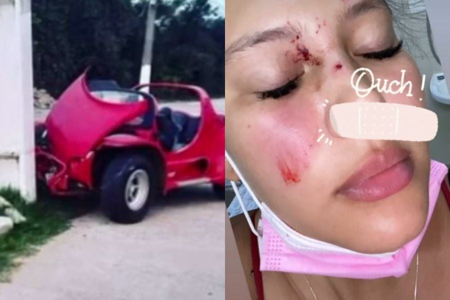 Michelle Carvalho muestra imágenes de grave accidente automovilístico: su auto quedó sin frenos