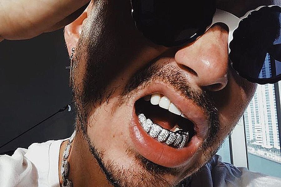 Grillz: una moda peligrosa