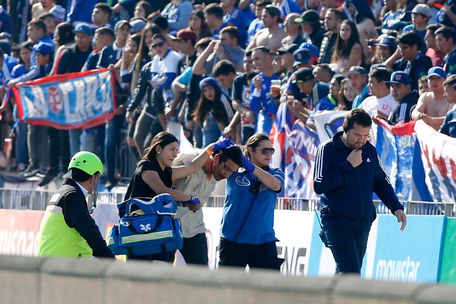 Fotógrafo Carlos Succo fue agredido por proyectil en el Nacional