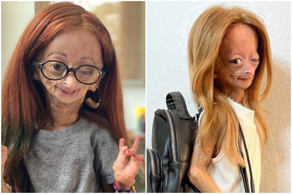 Adalia Rose Williams