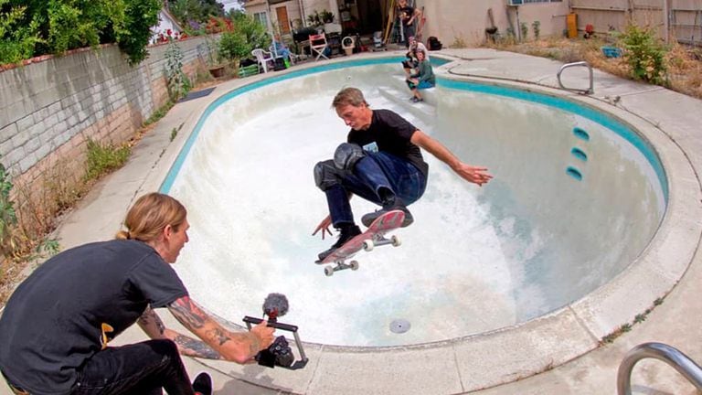 Tony Hawk impactó con imágenes de sus dedos fracturados