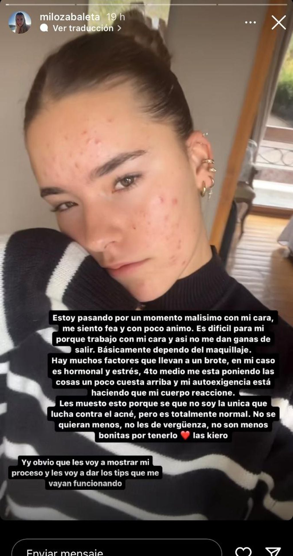 Hija de Jorge Zabaleta publicó cómo quedó su rostro debido al estrés: “Me siento fea y con poco ánimo”